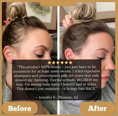 ✨ Ends Today: 70% OFF! 🌿100% pure Batana oil for promoting Hair Growth, Nourishing the scalp