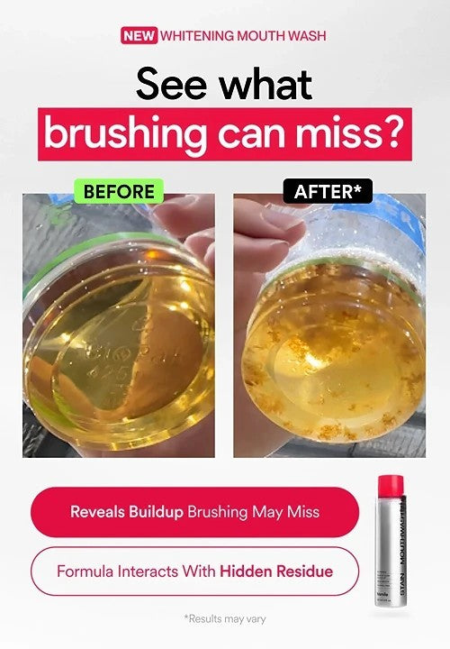 Whitening Mouthwash – Stain Removal & Fresh Breath